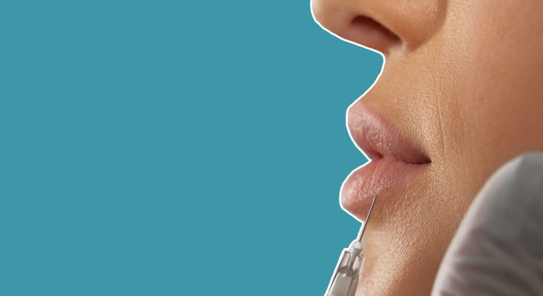 How Long Until You Can Workout After Lip Fillers (ANSWER)