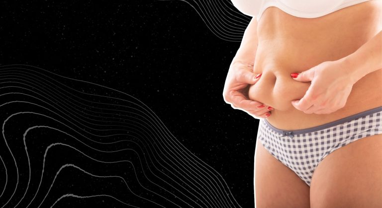 Difference Between Loose Skin vs Fat: What You Need to Know