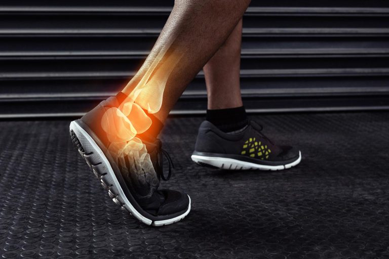 Best Ankle Braces for Basketball: Protect Your Ankles